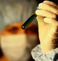 bagaimana untuk mendapatkan ujian untuk parasit