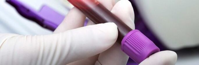 darah untuk ujian parasit