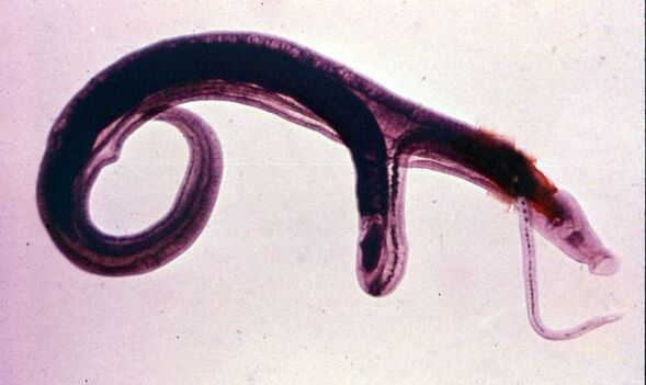 Skistosoma adalah salah satu parasit yang paling biasa dan berbahaya